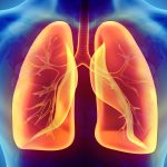 Dealing with AAT Deficiency and COPD