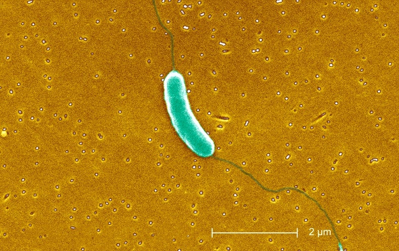 Flesh-Eating Micro organism Bacterial infections Are on the Rise in the U.S. Here’s How to Keep Risk-free