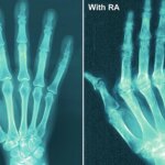 Fda Warns of Hidden Substances in Arthritis, Soreness Items