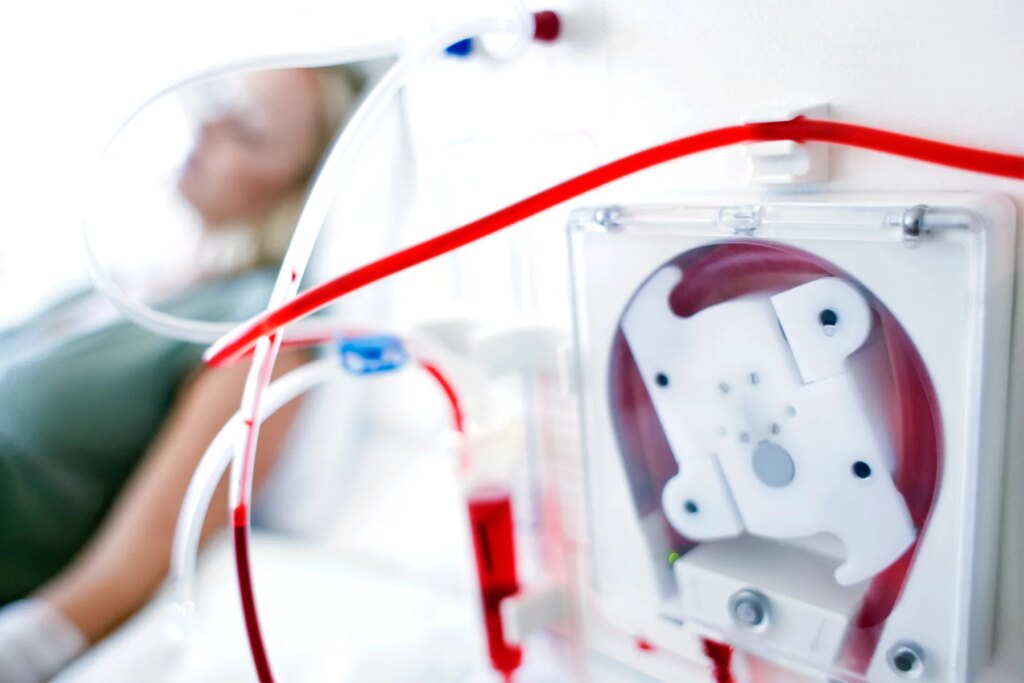 My Dialysis Equipment Performs as My Kidneys, for Now