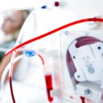 My Dialysis Equipment Performs as My Kidneys, for Now