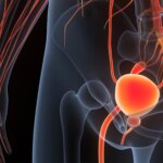 Lively Surveillance for Prostate Most cancers a Leap of Religion