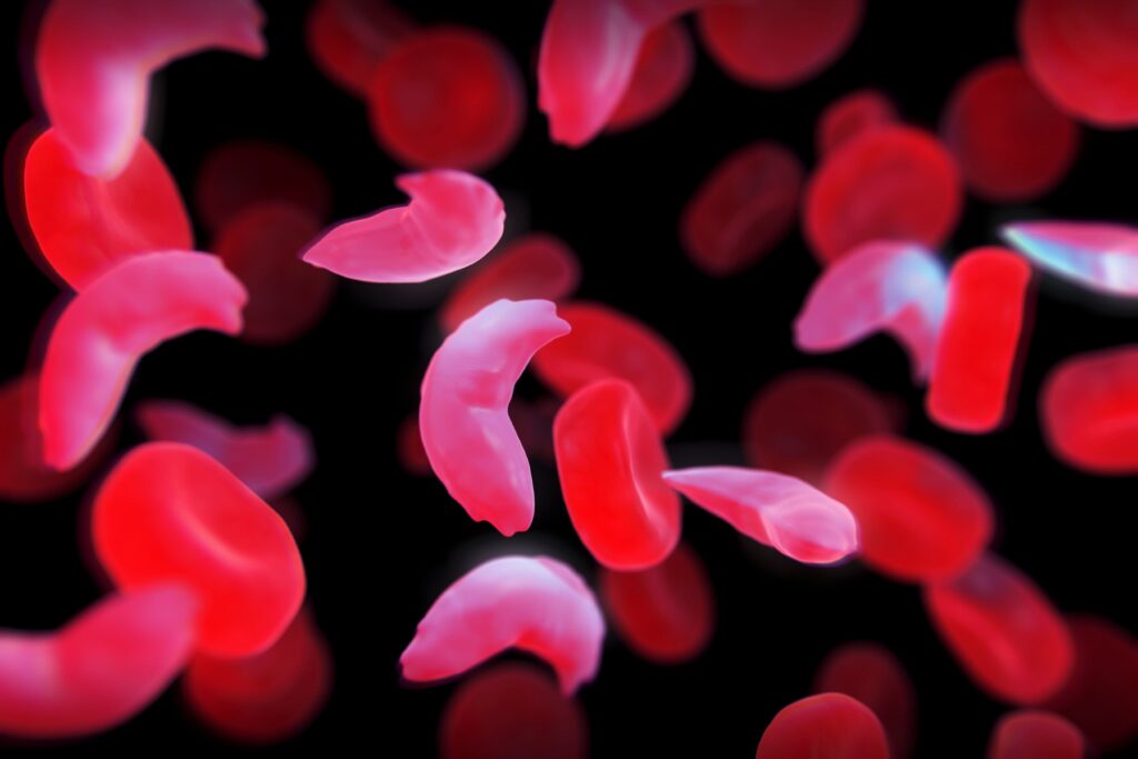 U.K. Turns into First State to Approve a CRISPR Sickness Procedure