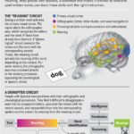 Too Many Schools Are Misdiagnosing Dyslexia