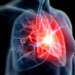 Chest Ache and Other Signals